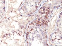 Formalin-fixed, paraffin embedded human testis sections stained with 100 ul anti-MAGE-1 (clone MA454) at 1:300. HIER epitope retrieval prior to staining was performed in 10mM Citrate, pH 6.0.